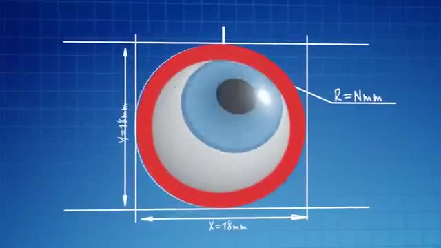 力学运动 · 第1集 · Полиспаст